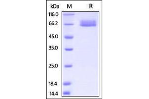 Cynomolgus IL-4 R alpha, Fc Tag on SDS-PAGE under reducing (R) condition.