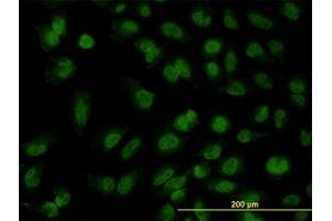 Image no. 3 for anti-Forkhead Box R2 (FOXR2) (AA 1-312) antibody (ABIN599326) (FOXR2 anticorps  (AA 1-312))