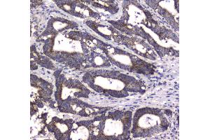 IHC analysis of MRE11 using anti-MRE11 antibody .