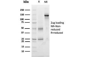 SDS-PAGE Analysis Purified Monospecific Mouse Monoclonal Antibody to TIGIT (TIGIT/3017).