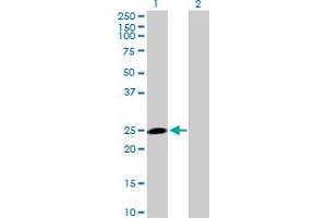 Western Blot analysis of HECTD3 expression in transfected 293T cell line by HECTD3 MaxPab polyclonal antibody. (HECTD3 anticorps  (AA 1-210))