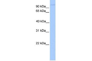 WB Suggested Anti-NUP98 Antibody Titration: 0. (NUP98 anticorps  (N-Term))