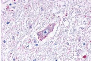 Anti-MRGPRD antibody  ABIN1049070 IHC staining of human brain, medulla. (MRGPRD anticorps  (Cytoplasmic Domain))
