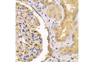 Immunohistochemistry of paraffin-embedded human kidney using USO1 antibody (ABIN5971479) at dilution of 1/200 (40x lens). (USO1 anticorps)