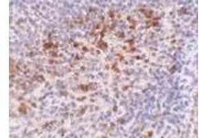 Immunohistochemistry of Catheli-cidin in human spleen tissue with Cathelicidin antibody at 5 μg/ml.