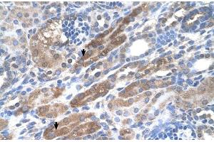 Human kidney (KIAA0319 anticorps  (N-Term))