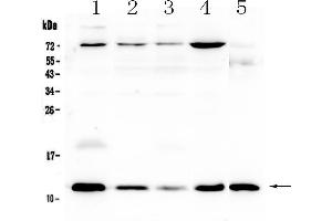 Western blot analysis of DYNLT1 using anti-DYNLT1 antibody . (DYNLT1 anticorps  (AA 1-80))