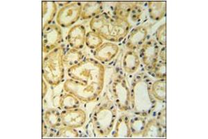 Immunohistochemistry analysis in Formalin Fixed, Paraffin Embedded Human lung tissue using RT25 antibody (C-term) followed by peroxidase conjugation of the secondary antibody and DAB staining. (MRPS25 anticorps  (C-Term))