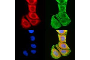 ABIN6259425 and ABIN6276230 staining Hela cells(30 min of UV treatment) by IF/ICC. (TMEM145 anticorps  (N-Term))