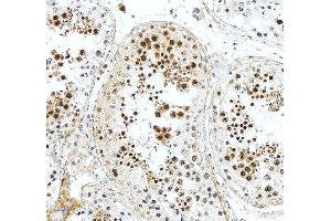 IHC analysis of DAZAP1 using anti-DAZAP1 antibody (ABIN6719309). (DAZAP1 anticorps  (AA 1-189))