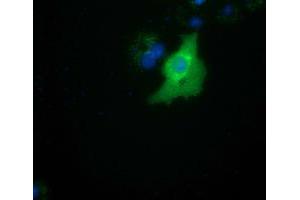 Anti-SMAD2 mouse monoclonal antibody (ABIN2453655) immunofluorescent staining of COS7 cells transiently transfected by pCMV6-ENTRY SMAD2 (RC204604). (SMAD2 anticorps)