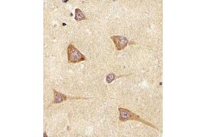 (ABIN650993 and ABIN2840027) staining EREG in Human brain tissue sections by Immunohistochemistry (IHC-P - paraformaldehyde-fixed, paraffin-embedded sections).