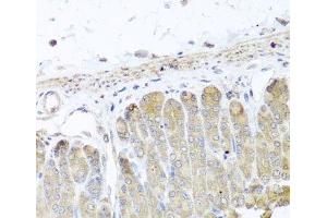 Immunohistochemistry of paraffin-embedded Mouse stomach using IRS2 Polyclonal Antibody at dilution of 1:100 (40x lens). (IRS2 anticorps)