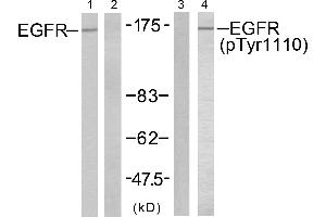 Western blot analysis of extracts from A431 cells untreated or treated with EGF (200ng/ml, 10mins), using EGFR (Ab-1110) antibody (Line 1 and 2) and EGFR (Phospho-Tyr1110) antibody (Line 3 and 4).
