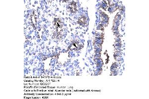 Human Lung (HIV-1 Tat Interactive Protein 2, 30kDa (HTATIP2) (N-Term) anticorps)