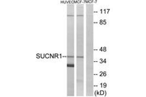 Western blot analysis of extracts from HuvEc/MCF-7 cells, using SUCNR1 Antibody. (SUCNR1 anticorps  (AA 100-149))