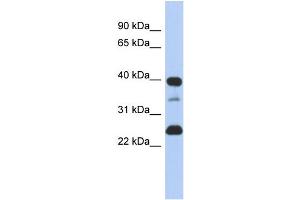 WB Suggested Anti-TMPO  Antibody Titration: 0. (Thymopoietin anticorps  (N-Term))