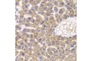 Immunohistochemistry of paraffin-embedded rat liver using FASTK antibody (ABIN5974251) at dilution of 1/100 (40x lens). (FASTK anticorps)