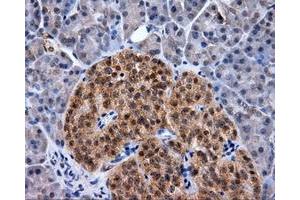 Immunohistochemical staining of paraffin-embedded Kidney tissue using anti-RC219453 mouse monoclonal antibody. (NPR3 anticorps)