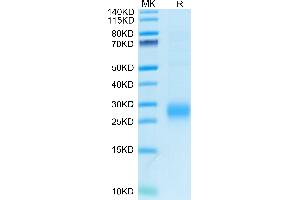 Human ALK-1/ACVRL1 on Tris-Bis PAGE under reduced condition.