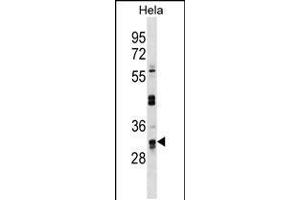 Western blot analysis in Hela cell line lysates (35ug/lane). (UTP11L anticorps  (C-Term))