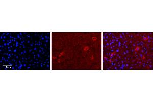Rabbit Anti-TUSC4 Antibody      Formalin Fixed Paraffin Embedded Tissue: Human Adult Liver   Observed Staining: Cytoplasm in hepatocytes, moderate signal, very low tissue distribution  Primary Antibody Concentration: 1:100  Secondary Antibody: Donkey anti-Rabbit-Cy3  Secondary Antibody Concentration: 1:200  Magnification: 20X  Exposure Time: 0.