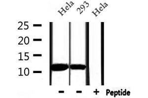 Western blot analysis of extracts from Hela and 293, using MIF Antibody. (MIF anticorps  (C-Term))