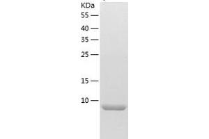 Chemokine (C-C Motif) Ligand 14 (CCL14) (AA 28-93) protein (His-IF2DI Tag)