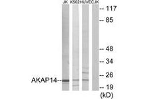 Western Blotting (WB) image for anti-A Kinase (PRKA) Anchor Protein 14 (AKAP14) (AA 1-50) antibody (ABIN2889659) (AKAP14 anticorps  (AA 1-50))