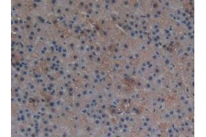 Detection of TXNRD1 in Rat Adrenal gland Tissue using Polyclonal Antibody to Thioredoxin Reductase 1 (TXNRD1) (TXNRD1 anticorps  (AA 208-433))