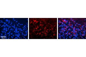 Rabbit Anti-SLC25A4 Antibody  Catalog Number: ARP43818_P050  Formalin Fixed Paraffin Embedded Tissue: Human Pineal Tissue  Observed Staining: Cytoplasmic in cell bodies of pinealocytes and their processes  Primary Antibody Concentration: 1:100  Other Working Concentrations: 1/600  Secondary Antibody: Donkey anti-Rabbit-Cy3  Secondary Antibody Concentration: 1:200  Magnification: 20X  Exposure Time: 0.