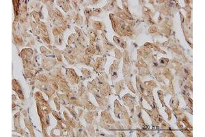 Image no. 1 for anti-Eukaryotic Translation Initiation Factor 4 gamma 2 (EIF4G2) (AA 811-890) antibody (ABIN598656) (EIF4G2 anticorps  (AA 811-890))