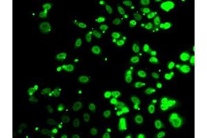 Immunofluorescence analysis of A549 cells using FIP1L1 antibody (ABIN5974293). (FIP1L1 anticorps)