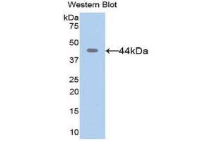 Western Blotting (WB) image for anti-Matrix Metallopeptidase 8 (Neutrophil Collagenase) (MMP8) (AA 101-467) antibody (ABIN1078309) (MMP8 anticorps  (AA 101-467))