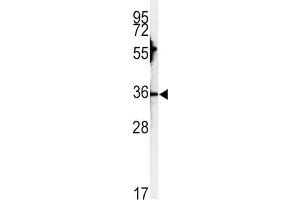 Western Blotting (WB) image for anti-Carbonic Anhydrase III (CA3) antibody (ABIN3003364) (CA3 anticorps)