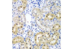 Immunohistochemistry of paraffin-embedded rat kidney using ADAD1 antibody at dilution of 1:200 (40x lens). (ADAD1 anticorps)