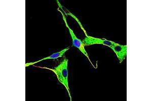 Immunofluorescence analysis of NIH/3T3 cells using GRK2 mouse mAb (green).