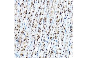 Immunohistochemistry of paraffin-embedded mouse stomach using FOX Rabbit pAb (5278) at dilution of 1:100 (40x lens). (FOXA1 anticorps  (AA 263-472))
