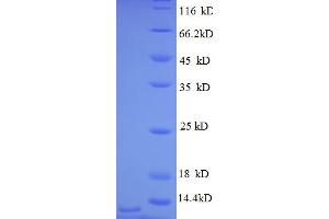 SDS-PAGE (SDS) image for Chemokine (C-X-C Motif) Ligand 3 (CXCL3) (AA 35-107) protein (His tag) (ABIN5712646)