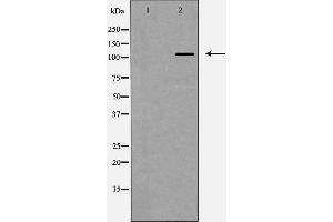 Western blot analysis of Integrin αV expression in HeLa cells,The lane on the left is treated with the antigen-specific peptide. (CD51 anticorps  (Internal Region))