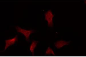 ABIN6269332 staining A431 by IF/ICC.