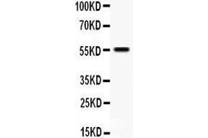 Anti- TFPI antibody, Western blotting All lanes: Anti TFPI  at 0. (TFPI anticorps  (N-Term))