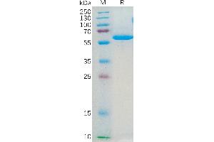 Human JAM-A Protein, hFc Tag on SDS-PAGE under reducing condition.