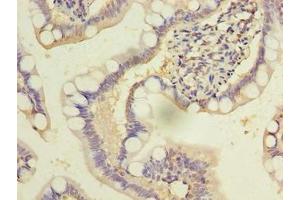 Immunohistochemistry of paraffin-embedded human small intestine tissue using ABIN7149679 at dilution of 1:100