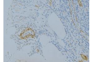 ABIN6275032 at 1/100 staining Human uterus tissue by IHC-P. (C1S anticorps  (C-Term))
