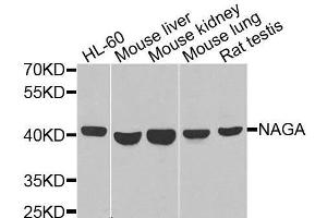 Western blot analysis of extracts of various cell lines, using NAGA antibody. (NAGA anticorps  (AA 312-411))
