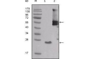 Western blot analysis using SRC mouse mAb against truncated SRC-His recombinant protein (1) and PMA treated THP-1 cell lysate (2). (Src anticorps  (AA 10-193))