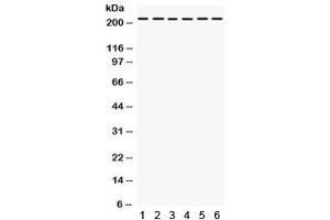 Western blot testing of 1) rat liver, 2) rat kidney, human 3) Jurkat, 4) 22RV1, 5) HepG2, 6) SMMC lysate with Integrin alpha 4 antibody.