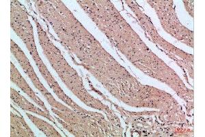 Immunohistochemical analysis of paraffin-embedded Human-colon, antibody was diluted at 1:100