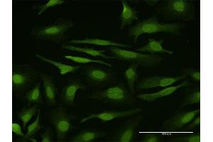 Immunofluorescence of purified MaxPab antibody to SMAD6 on HeLa cell. (SMAD6 anticorps  (AA 1-496))